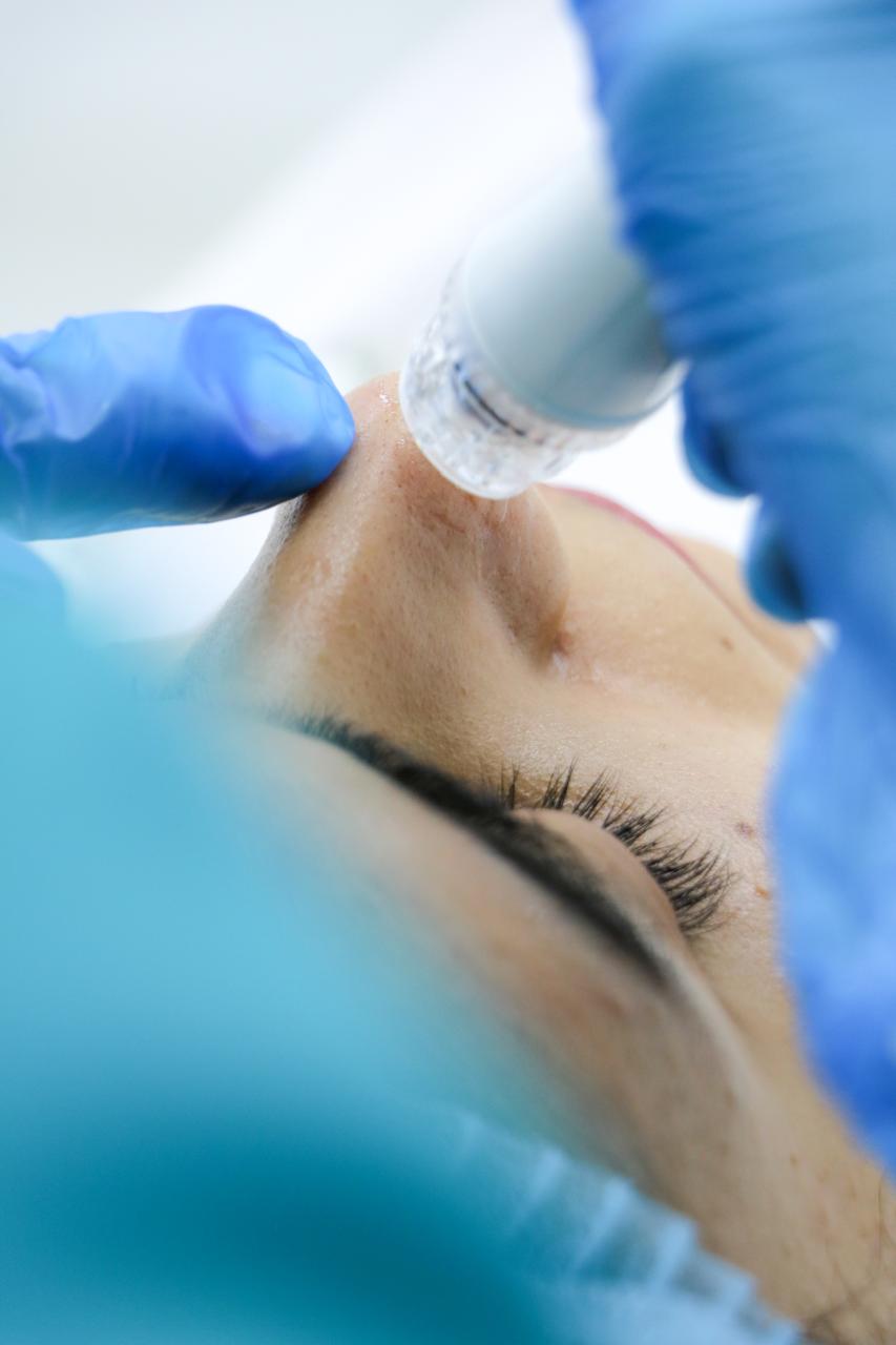 Nose Treatment